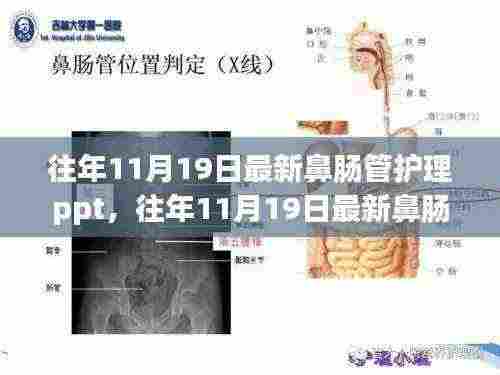 往年11月19日最新鼻肠管护理PPT详解与评测指南