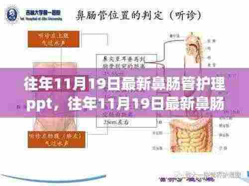 往年11月19日最新鼻肠管护理PPT详解与评测指南