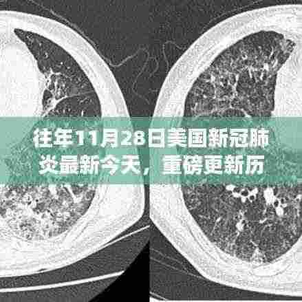 重磅更新,美国历年11月28日新冠肺炎科技突破——智能医疗设备重塑抗疫生活体验!