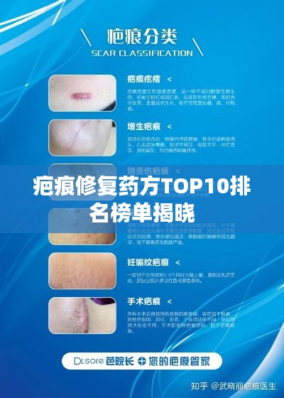 疤痕修复药方TOP10排名榜单揭晓