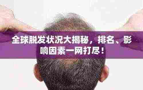 全球脱发状况大揭秘,排名、影响因素一网打尽!