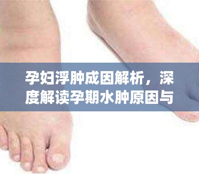 孕妇浮肿成因解析,深度解读孕期水肿原因与应对之道