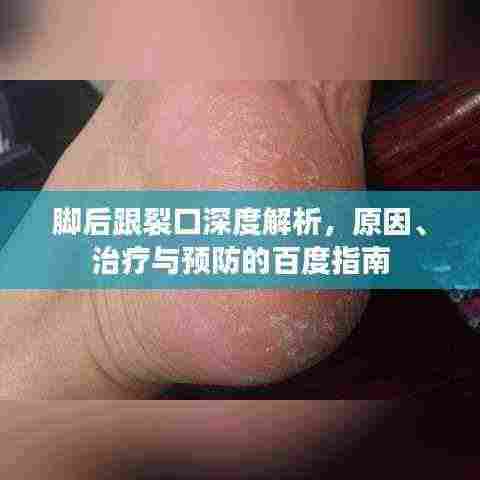 脚后跟裂口深度解析,原因、治疗与预防的百度指南
