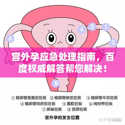 宫外孕应急处理指南，百度权威解答帮您解决！