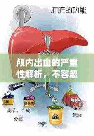 颅内出血的严重性解析,不容忽视的健康警示